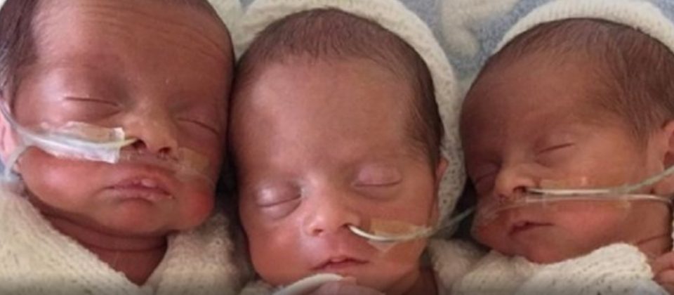 Родила три бебиња, а кога им ги видела лицата следувал шок: Ова е медицински феномен (ФОТО)