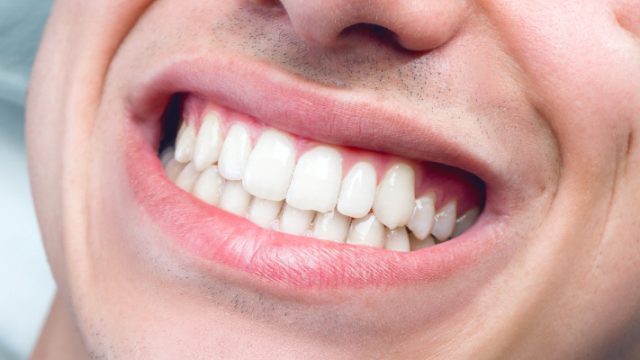 Колку заби сте изгубиле досега? Тоа кажува колку долго ќе живеете!