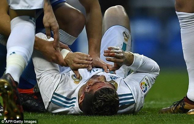 ВИДЕО: Роналдо со раскрварена глава, извади мобилен да ја види повредата