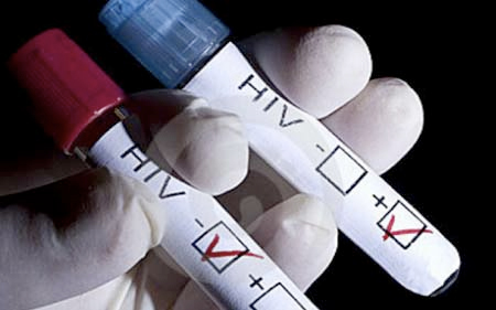 Научници сметаат дека се блиску до пронаоѓање лек за ХИВ