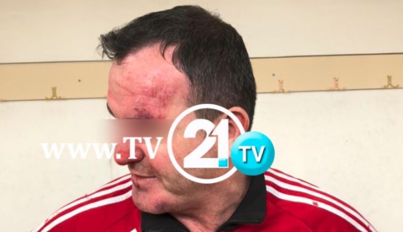 ФОТО: Професори од Гостивар нападнати со метален боксирач