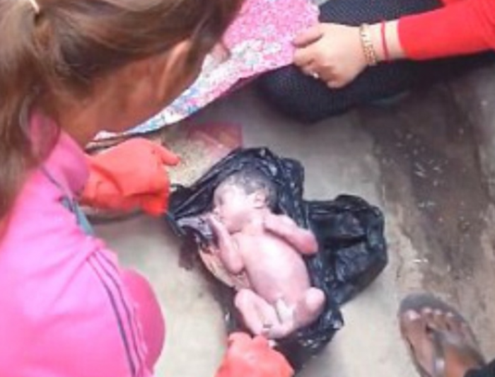 Вистинско чудо: Бебе преживеало во куп ѓубре, замотано во пластична кеса било оставено на депонија (ВИДЕО)