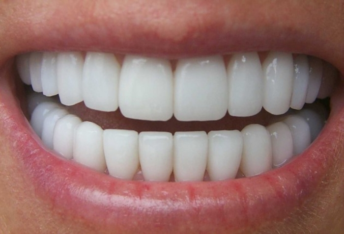 Секојдневни намирници благотворни за бели заби