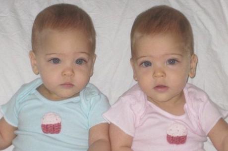 Пред 8 години се родија најубавите близначки на светот, погледнете како изгледаат денес (ФОТО)