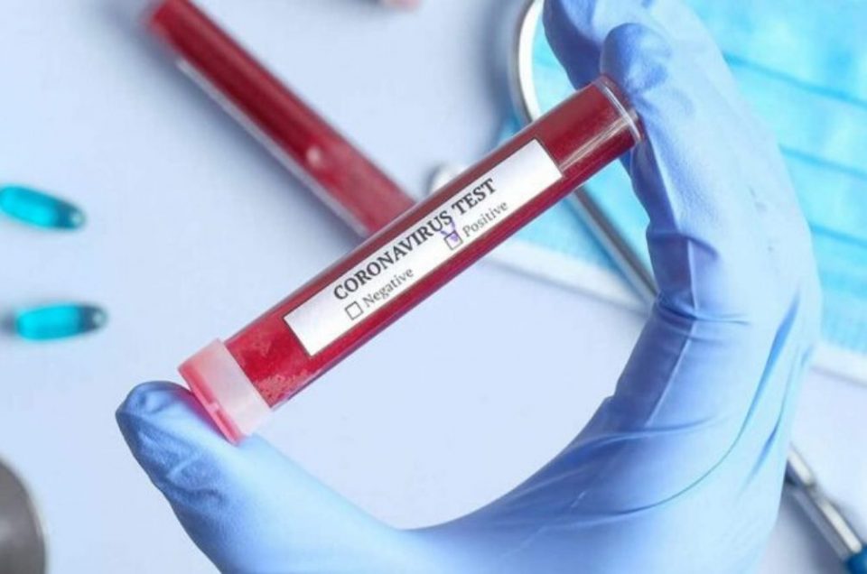Новоинфицирани шест лица од коронавирусот во Општина Дојран