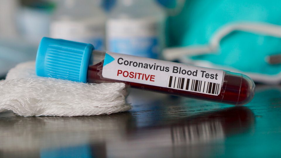 Бројот на заразени со новиот коронавирус во Словенија се зголеми на 181