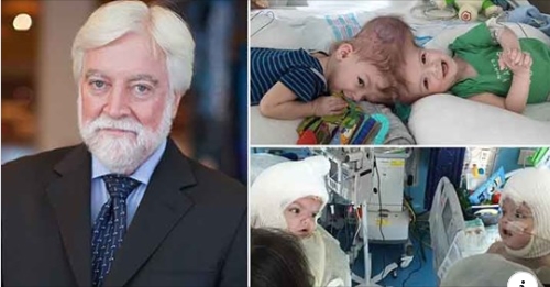 Почина докторот кој во 27 часовна операција одвои сијамски близнаци споени со главите (ФОТО)