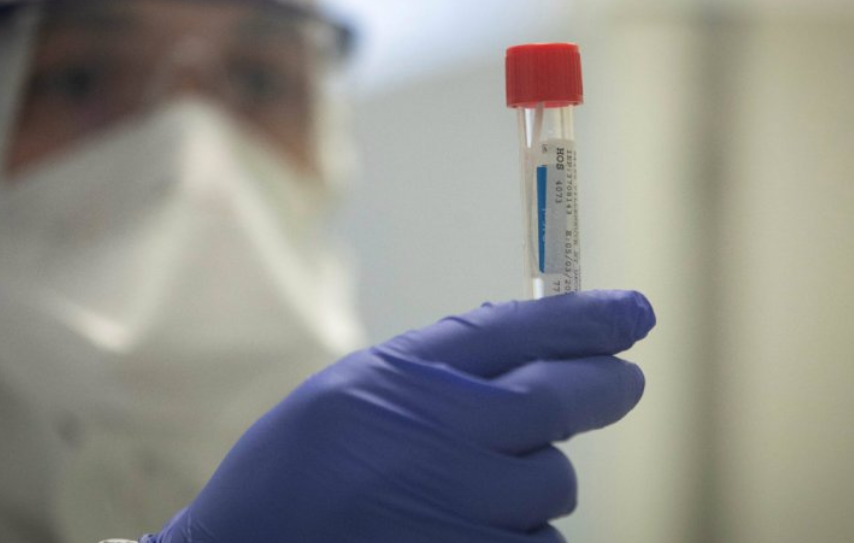 Франција предупредува: Некои лекови можат да ја влошат состојбата на болни од коронавирус