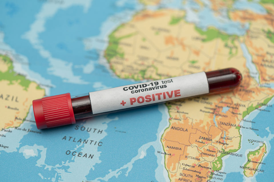 Африка на удар на коронавирусот – починати над 5.600 лица, расте бројот на заболени