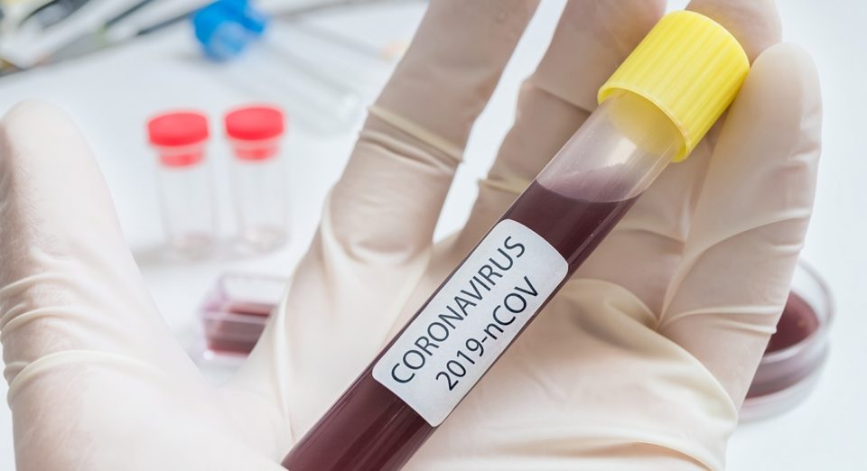 Опаѓа бројот на починати од коронавирус во Турција