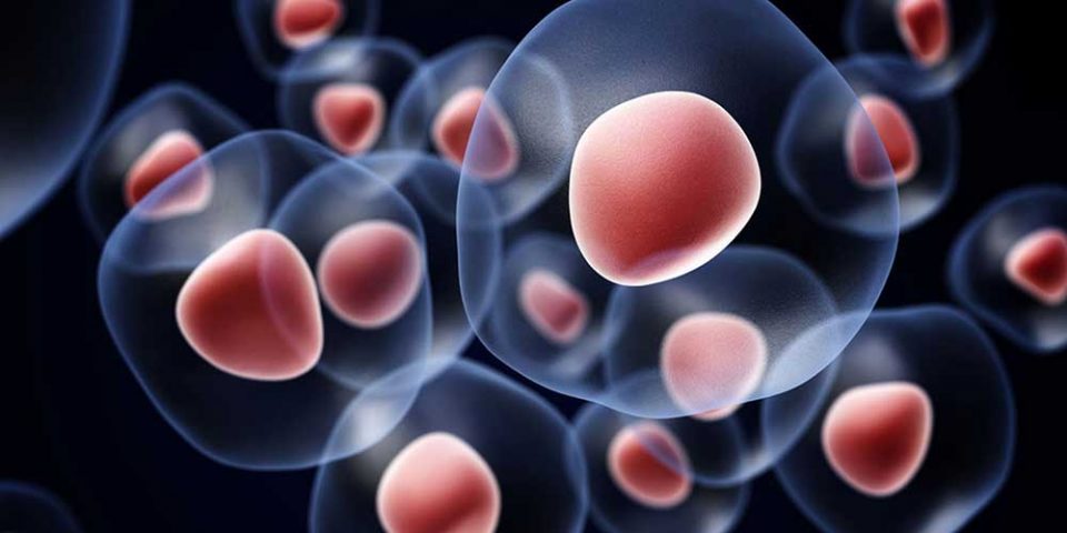 Клиника за хематологија: Успешно спроведена несродна трансплантација на матични хематопоетски клетки