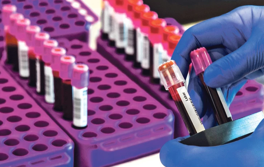 Наместо ПЦР, да се користат брзите антигенски тестови пред некои операции – препорачува Комисијата за заразни болести