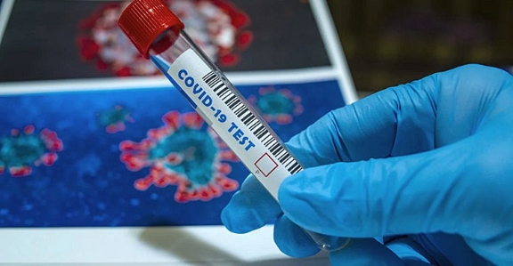 Во Хрватска намалена цената на тестовите за коронавирус