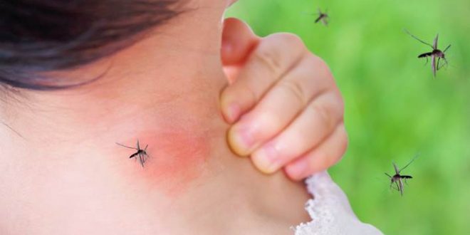 Дојде времето на комарците: Еве неколку намирници кои ќе ви го ублажат отокот од нивниот убод