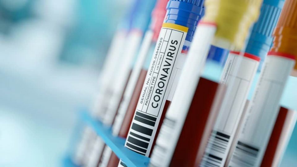 Светот наскоро добива тестови за коронавирус кои даваат резултати за 30 минути
