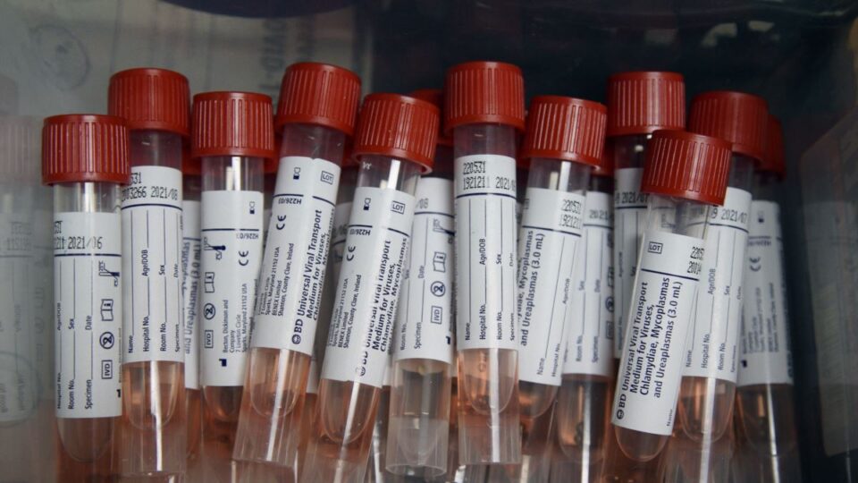 Во Македонија пациент кој не примил ниту една доза вакцина „фатил“ корона и по четврти пат