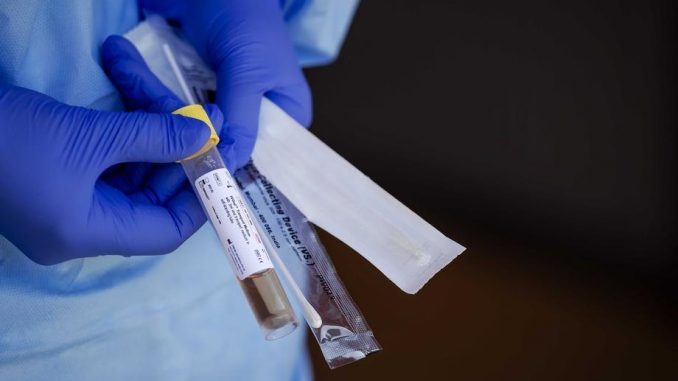 Кривична пријава против три лица за користење лажни антиген тестови