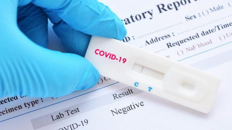 Обвинет 32 годишен државјанин на Турција за фалсификување ПЦР тест за коронавирус