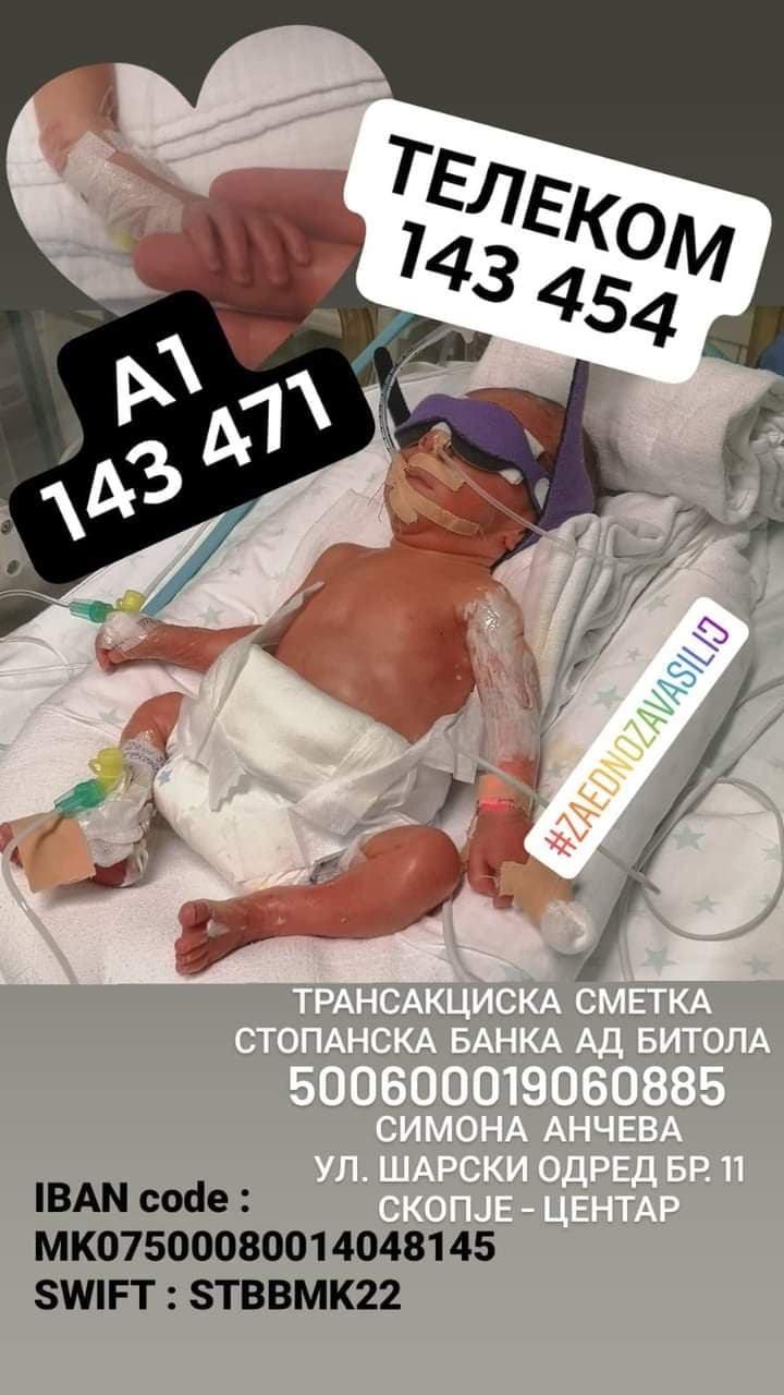 ДА БИДЕМЕ ХУМАНИ: Малиот Василиј има потреба од нас, потребна е само помош од 100 денари на 143-454 Телеком и 143-471 А1