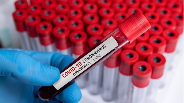 Омикрон мутацијата на коронавирус потврдена во 38 земји, СЗО со ново предупредување