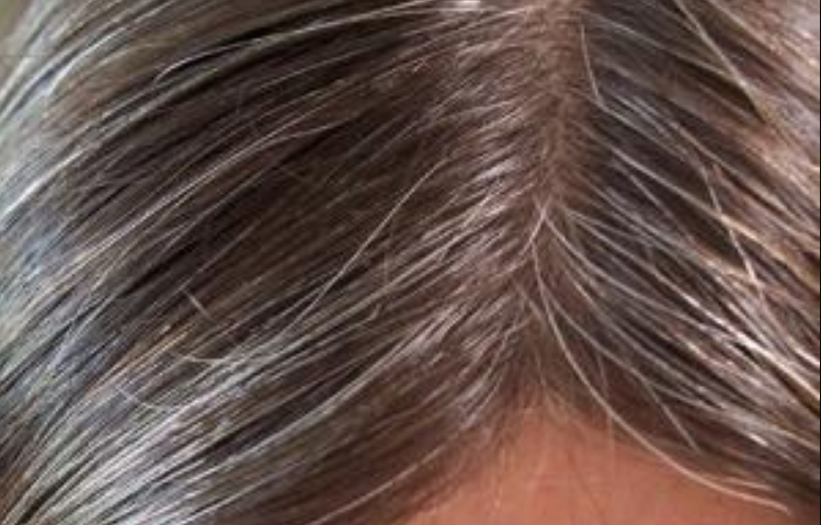 Не се само гените проблем: Поради овие три причини се случува побелување на косата