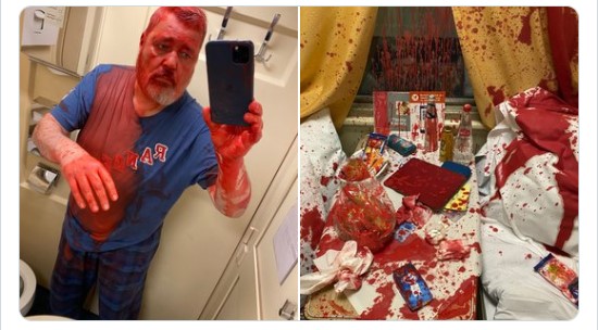 Уредник на руски медиум нападнат во воз: Тоа што го гледате не е крв!