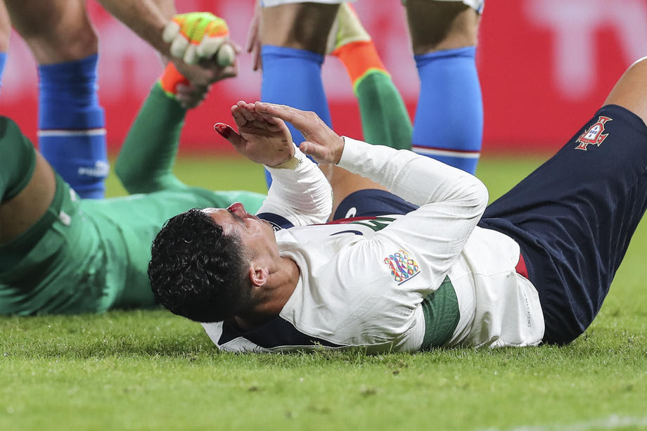 ФОТО: Роналдо го повреди носот на мечот со Чешка