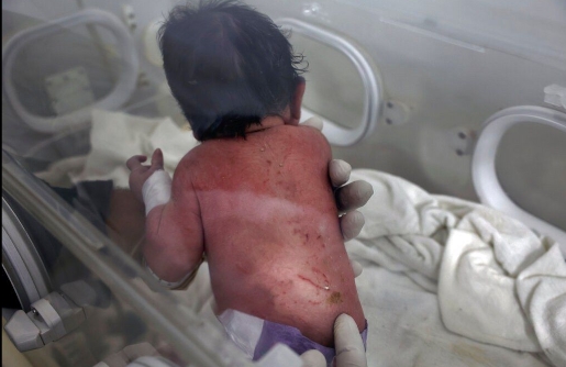 ФОТО: Еве како денес изгледа бебето родено под урнатините на силниот земјотрес кој ги погоди Турција и Сирија